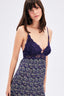 Mini Print Dress With Lace Detail